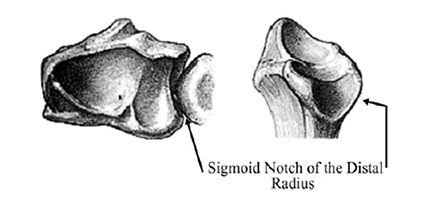 Bony anatomy of the DRUJ of the wrist. The sigmoid notch forms the articular surface of the distal radius of the DRUJ, a joint that allows for forearm rotation.